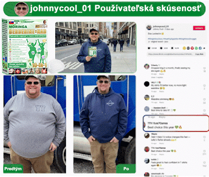🇸🇰𝐕𝐲𝐯𝐢𝐧𝐮𝐭é 𝐥𝐞𝐤á𝐫𝐦𝐢🩺 𝐀𝐌𝐙𝐊𝐄𝐄𝐏® 𝐌𝐨𝐫𝐢𝐧𝐠𝐚 𝐁𝐞𝐫𝐛𝐞𝐫𝐢𝐧𝐞 × 𝐍𝐀𝐃+ 𝟏𝟎-𝐯-𝟏 𝐏𝐨𝐤𝐫𝐨č𝐢𝐥á 𝐧𝐚𝐧𝐨 𝐦𝐢𝐤𝐫𝐨𝐢𝐡𝐥𝐢č𝐤𝐨𝐯á 𝐧á𝐩𝐥𝐚𝐬ť (𝐕𝐢𝐝𝐢𝐭𝐞ľ𝐧é 𝐯ý𝐬𝐥𝐞𝐝𝐤𝐲 𝐮ž 𝐳𝐚 𝟕 𝐝𝐧í)