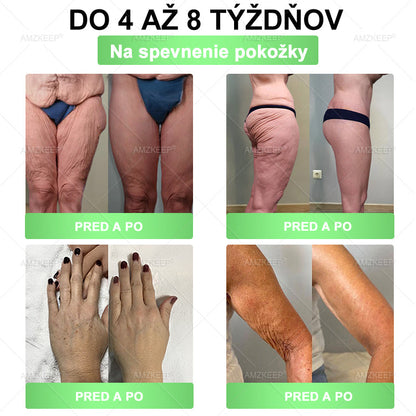🇸🇰𝐕𝐲𝐯𝐢𝐧𝐮𝐭é 𝐥𝐞𝐤á𝐫𝐦𝐢🩺 𝐀𝐌𝐙𝐊𝐄𝐄𝐏® 𝐌𝐨𝐫𝐢𝐧𝐠𝐚 𝐁𝐞𝐫𝐛𝐞𝐫𝐢𝐧𝐞 × 𝐍𝐀𝐃+ 𝟏𝟎-𝐯-𝟏 𝐏𝐨𝐤𝐫𝐨č𝐢𝐥á 𝐧𝐚𝐧𝐨 𝐦𝐢𝐤𝐫𝐨𝐢𝐡𝐥𝐢č𝐤𝐨𝐯á 𝐧á𝐩𝐥𝐚𝐬ť (𝐕𝐢𝐝𝐢𝐭𝐞ľ𝐧é 𝐯ý𝐬𝐥𝐞𝐝𝐤𝐲 𝐮ž 𝐳𝐚 𝟕 𝐝𝐧í)